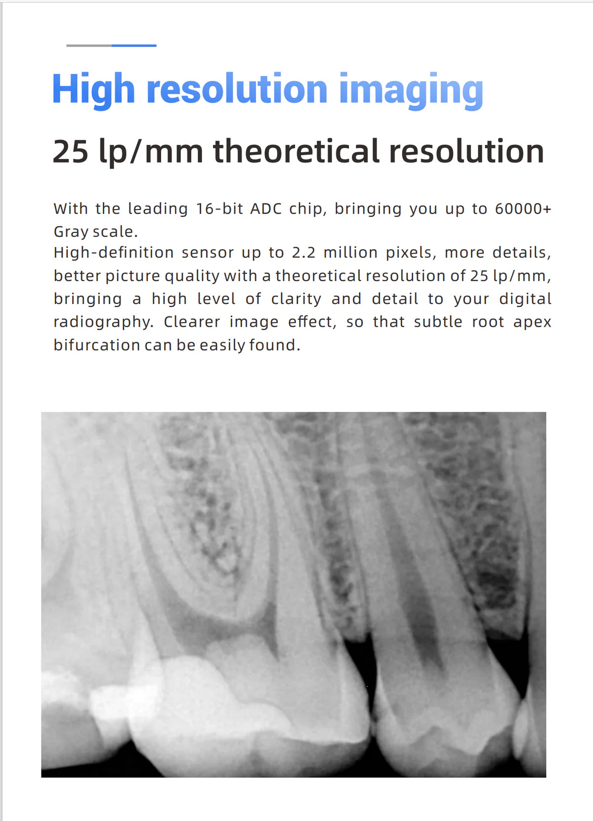Woodpecker Intraoral Sensor Size 1