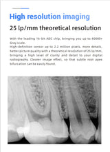 Woodpecker Intraoral Sensor Size 1