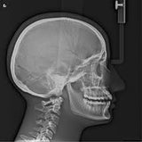 ImageWorks Panoura 18S Pan with Ceph (with Acq PC)