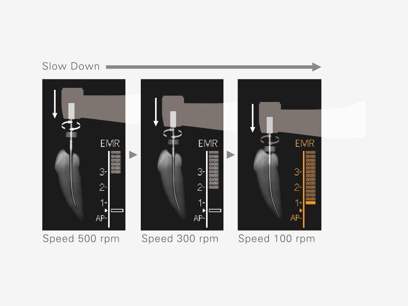J. Morita Tri Auto ZX2+ Cordless Apex Locator