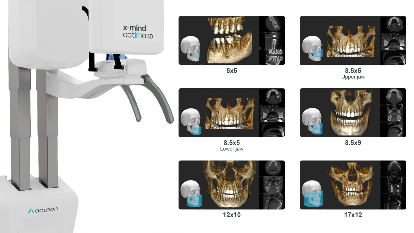 Acteon Optima 3D CBCT 17x12 FOV