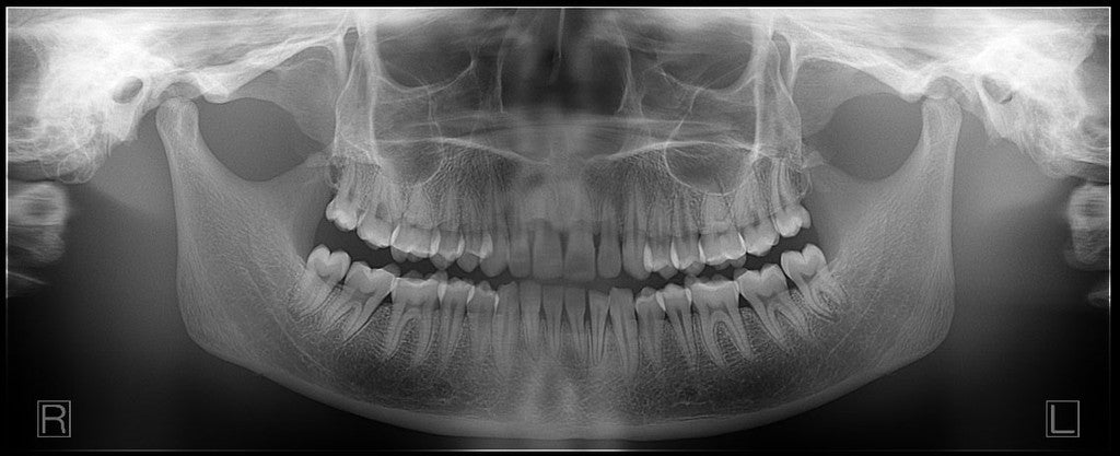dental radiology fmx